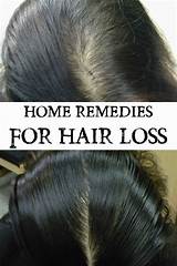 Hair Loss Reasons And Natural Treatments