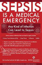 Photos of What Is The Medical Condition Sepsis