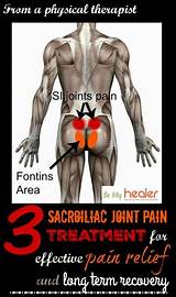Pictures of Sacroiliac Joint Pain Treatment Exercises