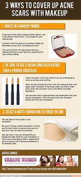 Makeup Tips For Acne Scars Pictures