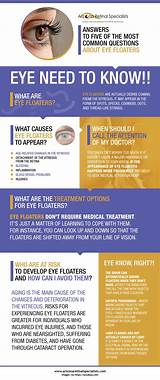 Causes Eye Floaters Mayo Clinic