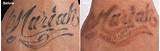 Laser Tattoo Removal Pictures After 1 Treatment Images