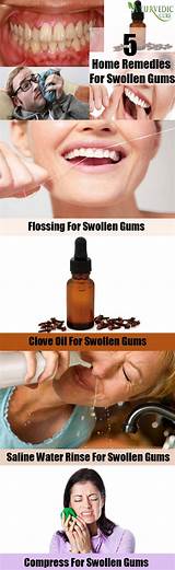 Gum Doctor Natural Remedy Images