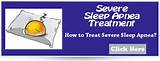 Pictures of Severe Obstructive Sleep Apnea Treatment