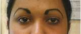 Eyebrow Permanent Makeup Before And After Photos