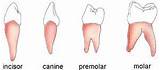 Canine Gingivitis Home Remedies Photos
