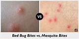 How To Tell A Mosquito Bite From A Bed Pictures