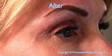 Learn To Do Permanent Makeup Photos