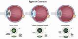 Different Kinds Of Eye Doctors Images