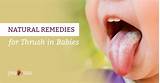 Natural Treatment For Thrush On Tongue Pictures