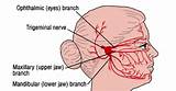 Photos of Left Side Jaw Pain That Comes And Goes