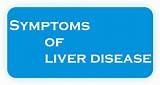 Photos of Fatty Liver Pain Medication