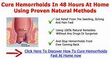 Images of Hemorrhoids Home Remedies Itching
