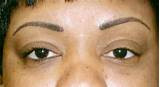 Pictures of Eyebrow Permanent Makeup Before And After