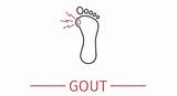 What Kind Of Doctor For Gout Pictures