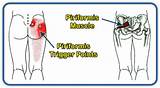Piriformis Muscle Strengthening Pictures