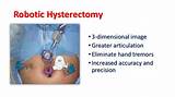 Images of Recovery Period After Hysterectomy