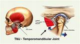 Tmj Medical Term Pictures