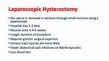 Recovery From Hysterectomy And Oophorectomy Photos