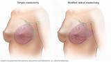 Pictures of Mayo Clinic Breast Center