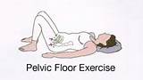 Pictures of Pelvic Muscle Strengthening Exercises