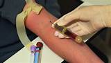 Pictures of Classes To Be A Phlebotomist