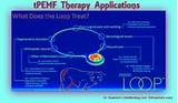 Electromagnetic Treatment For Chronic Pain Images