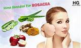 Pictures of Home Remedies For Rosacea