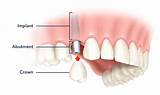 Aliso Dental Care Images