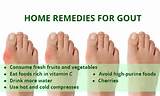 Images of Home Remedies Gout Attack