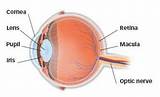 Treatment For Hole In Retina Of Eye