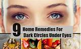 Darkness Around Eyes Home Remedies Images