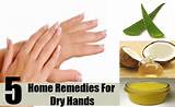 Dry Hands Home Remedies