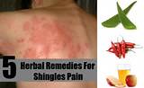 Any Home Remedies For Shingles Images