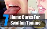 Pictures of Salivary Gland Home Remedies