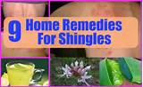 Photos of Any Home Remedies For Shingles