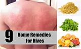 Photos of Home Remedies Web