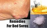 Bed Sores Images