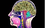 Images of What Does Marijuana Do To Your Body And Brain