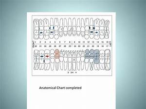 Dental Charting Symbols Quiz Best Picture Of Chart Anyimage Org