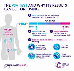 Why A One Off Psa Test For Cancer Is Doing Men More Harm Than