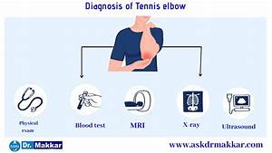 Tennis Elbow Lateral Epicondylitis Causes Symptoms