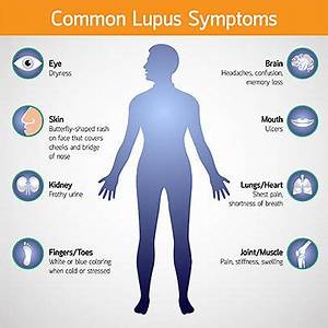 The Signs And Symptoms Of Lupus Everyday Health