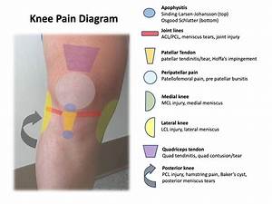 Knee Diagram Meniscus 