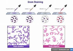 Gram Staining Definition Diagram Principle And Procedure Pdf