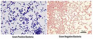 Gram Staining Principle Procedure Interpretation And Animation