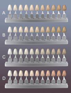 Precise Color Matching Rockefeller Cosmetic Dentistry