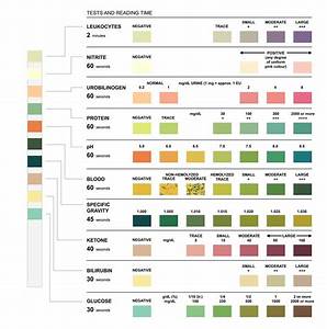 Urine Color Chart Urine In Test Tubes Medical Vector Image 6 Reasons
