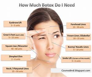 Image Result For Botox Injection Sites Chart Botox Injection Sites