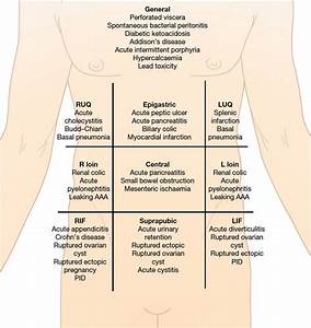 Acute Abdominal And Starting Ddx By Quadrant Doctor Stuff